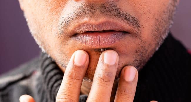 Close-up of a man’s lower face with dry, cracked lips and rough skin, illustrating physical symptoms like dehydration and poor hygiene that contribute to the condition known as "meth face."